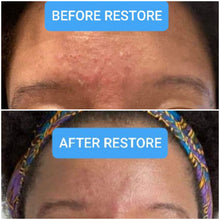 Load image into Gallery viewer, Skin & Scalp Inflammation