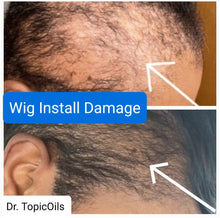 Load image into Gallery viewer, Dr. TopicOils 1 Month Nutritive Scalp Elixir Growth Kit