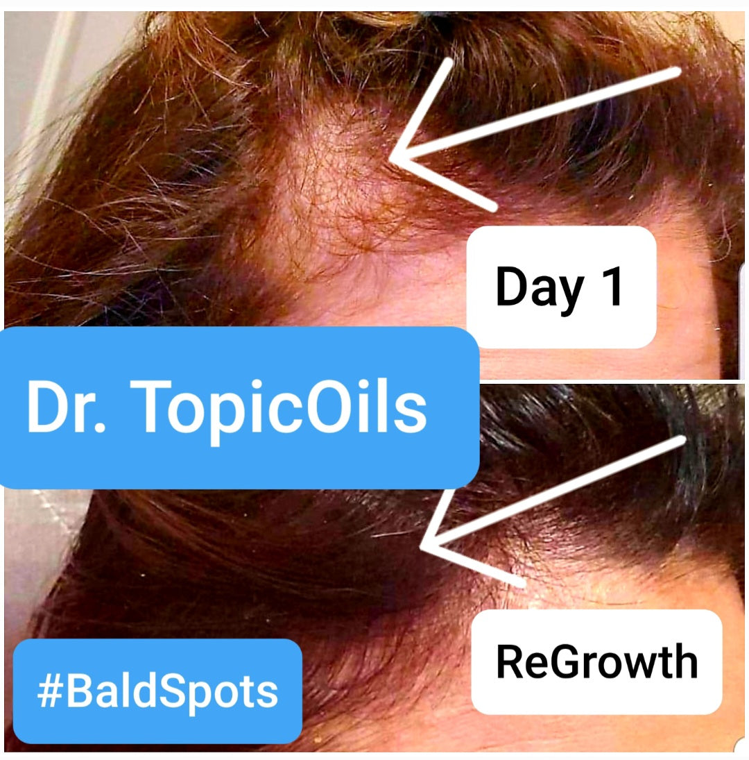 Dr. TopicOils Nutritive Scalp Elixir For Thinning Hair (Men & Women)