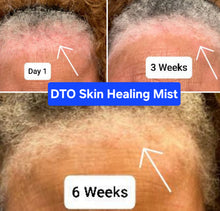 Load image into Gallery viewer, Skin & Scalp Inflammation