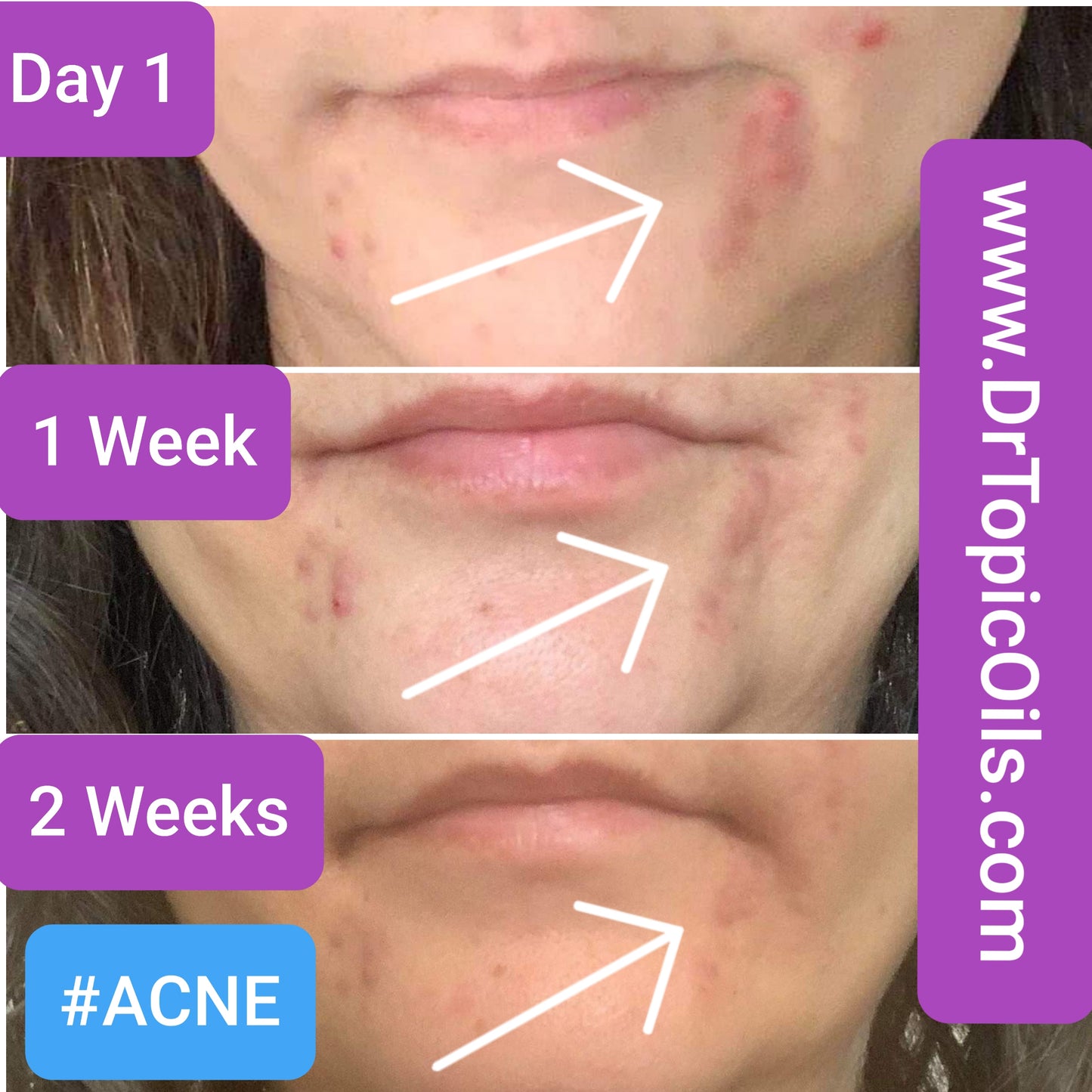 RESTORE Skin Healing Mist for Skin & Scalp Inflammation
