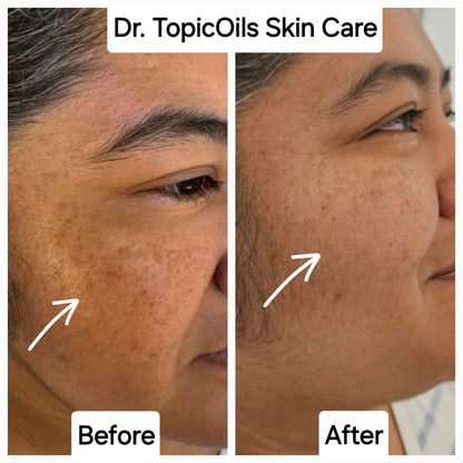 Dr. TopicOils Skin Healing Balm for Youthful Looking Skin & Décollete'