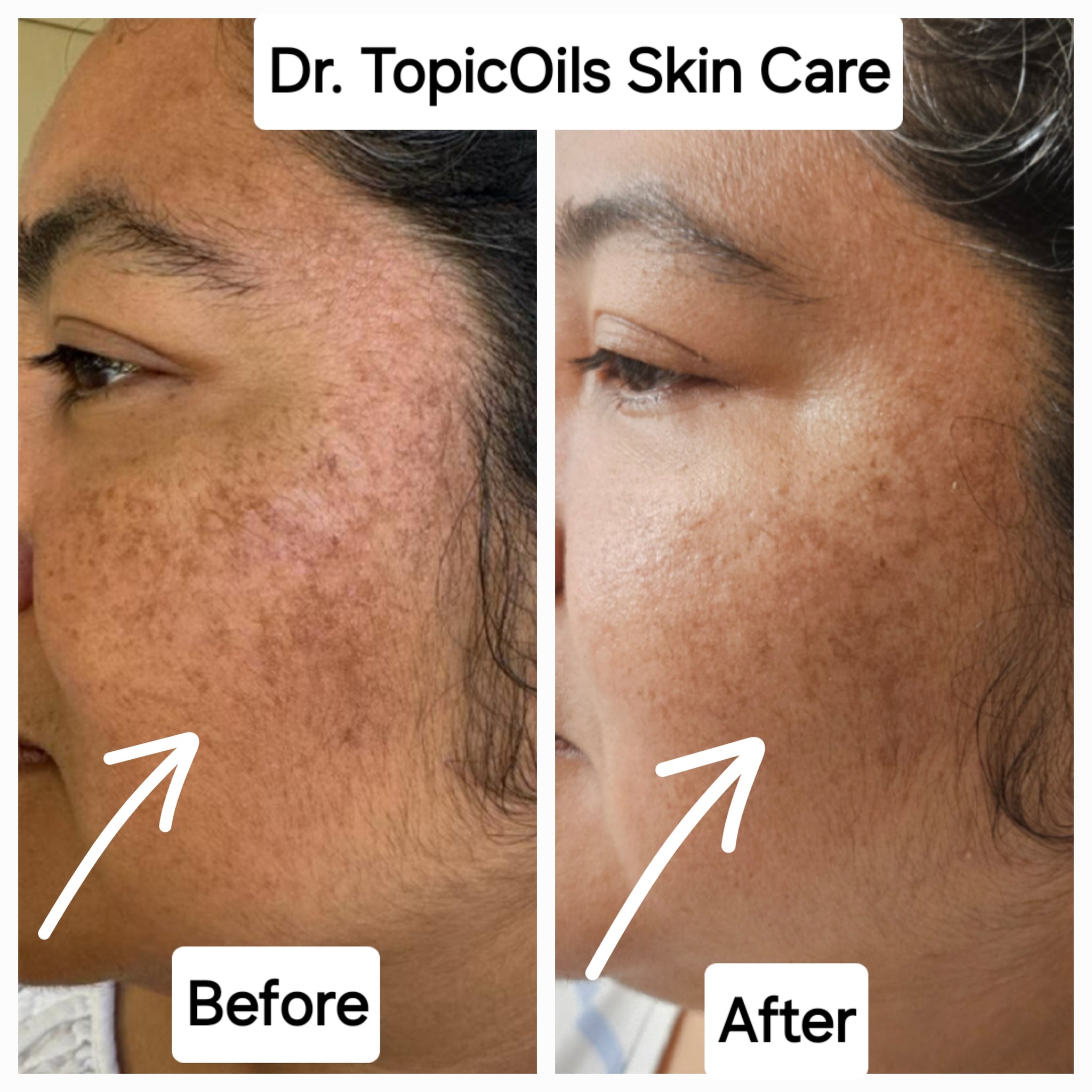 Dr. TopicOils Skin Healing Balm for Youthful Looking Skin & Décollete'