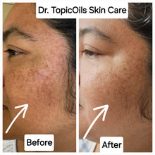 Load image into Gallery viewer, Dr. TopicOils Skin Healing Balm for Youthful Looking Skin &amp; Décollete&#39;
