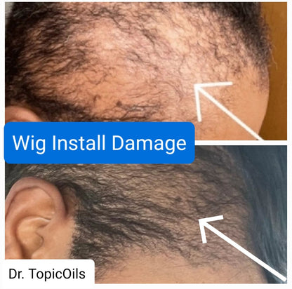 Dr. TopicOils Nutritive Scalp Elixir Growth Kit