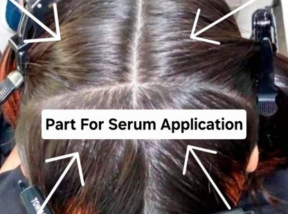 Dr. TopicOils Nutritive Scalp Elixir (NSE) For Rapid Hair Growth (1 Month supply)