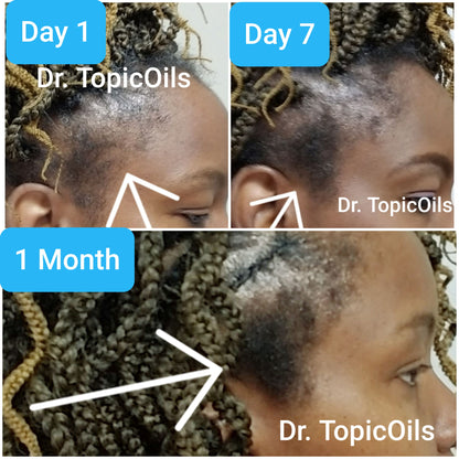 Dr. TopicOils Nutritive Scalp Elixir Growth Kit (2 Month Supply)