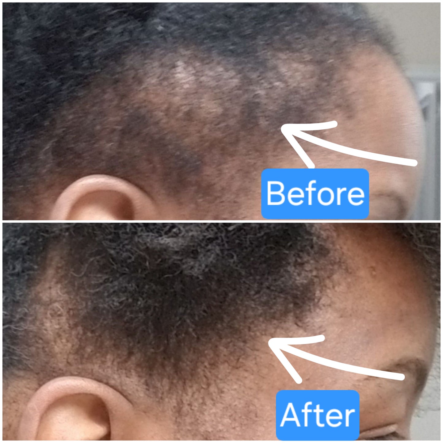 Dr. TopicOils Nutritive Scalp Elixir Growth Kit (2 Month Supply)
