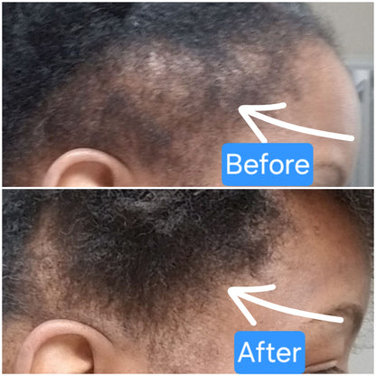 Dr. TopicOils Nutritive Scalp Elixir Growth Kit (2 Month Supply)