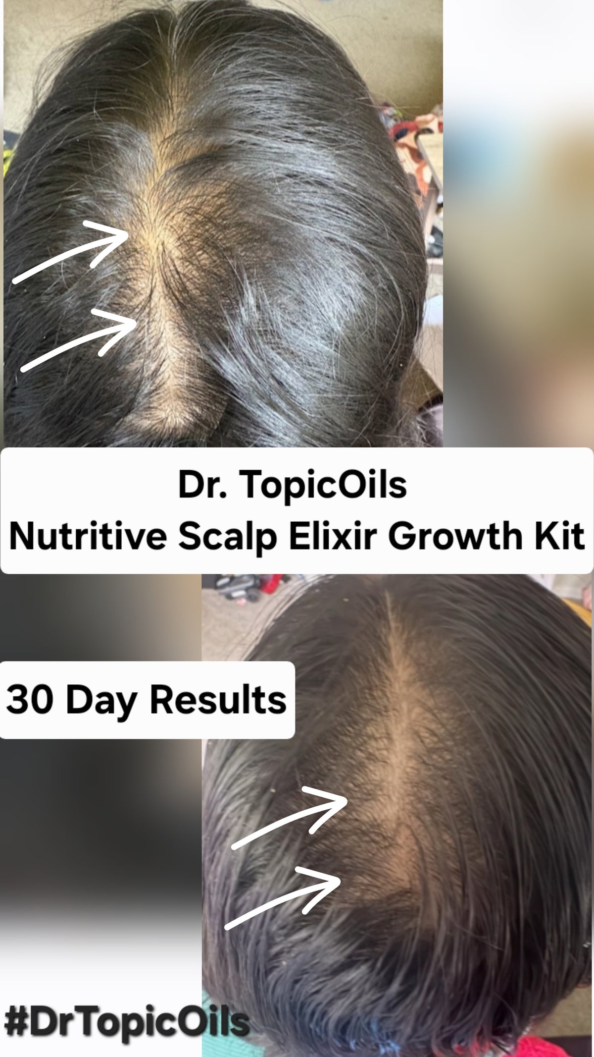 Dr. TopicOils Nutritive Scalp Elixir Growth Kit (2 Month Supply)