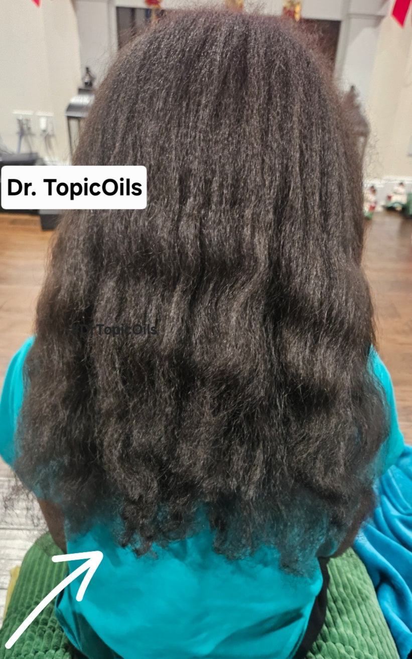 Dr. TopicOils Nutritive Scalp Elixir (NSE) For Rapid Hair Growth (1 Month supply)