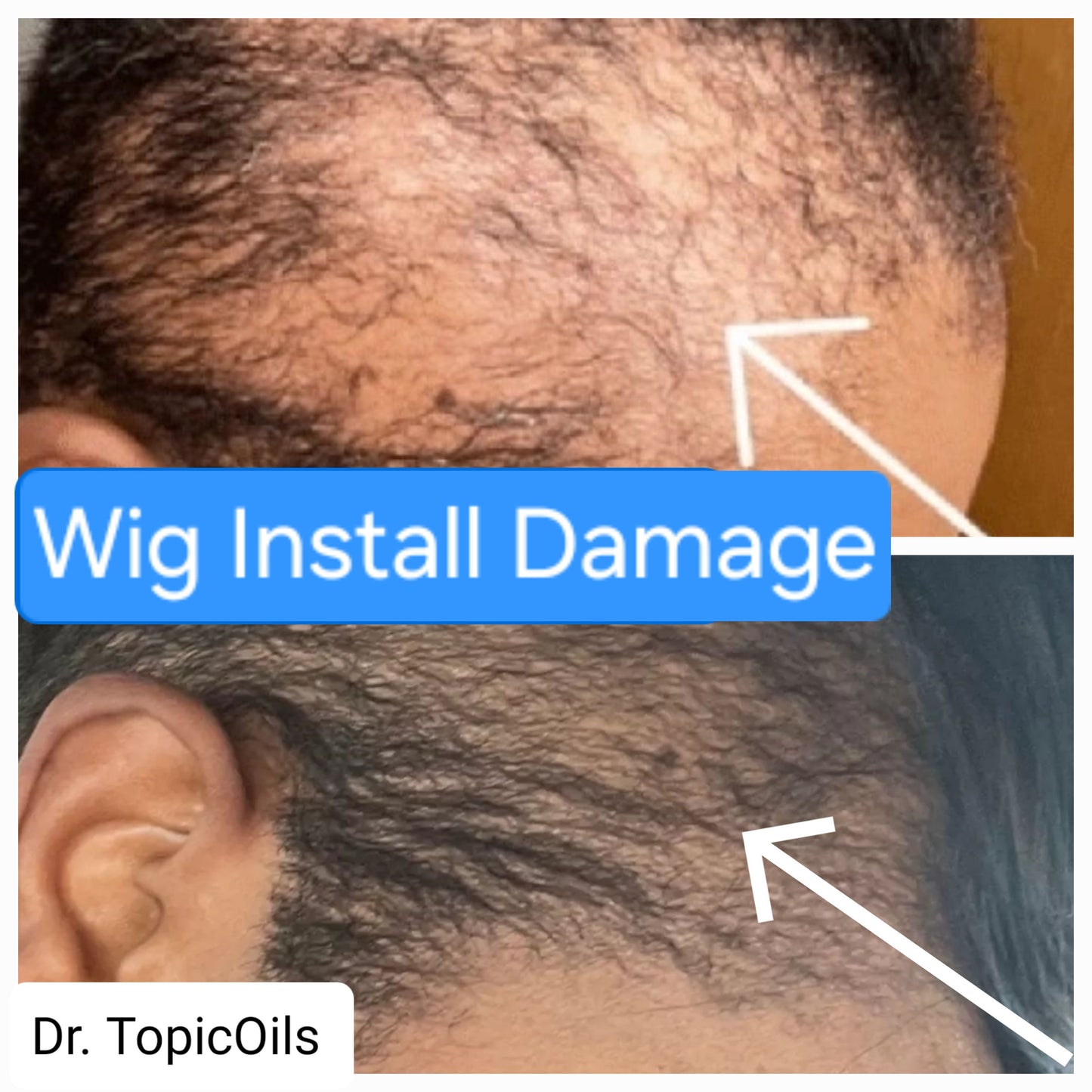 Dr. TopicOils Nutritive Scalp Elixir Growth Kit (2 Month Supply)