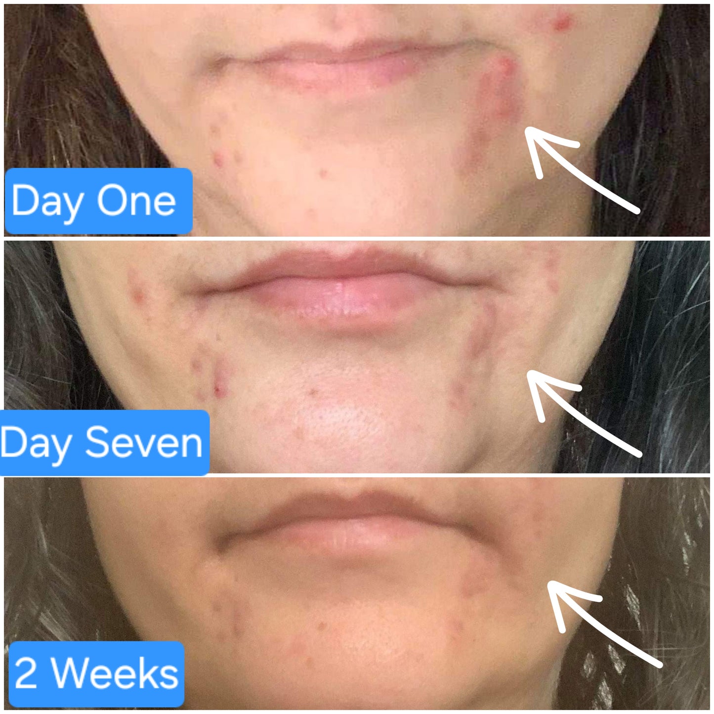 RESTORE Skin Healing Mist for Skin & Scalp Inflammation