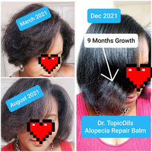 Load image into Gallery viewer, Dr. TopicOils &quot;Curly Hair&quot; Growth Bundle For Early Stage Alopecia and Slow Growth
