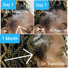 Load and play video in Gallery viewer, Dr. TopicOils &quot;Curly Hair&quot; Growth Bundle For Early Stage Alopecia and Slow Growth
