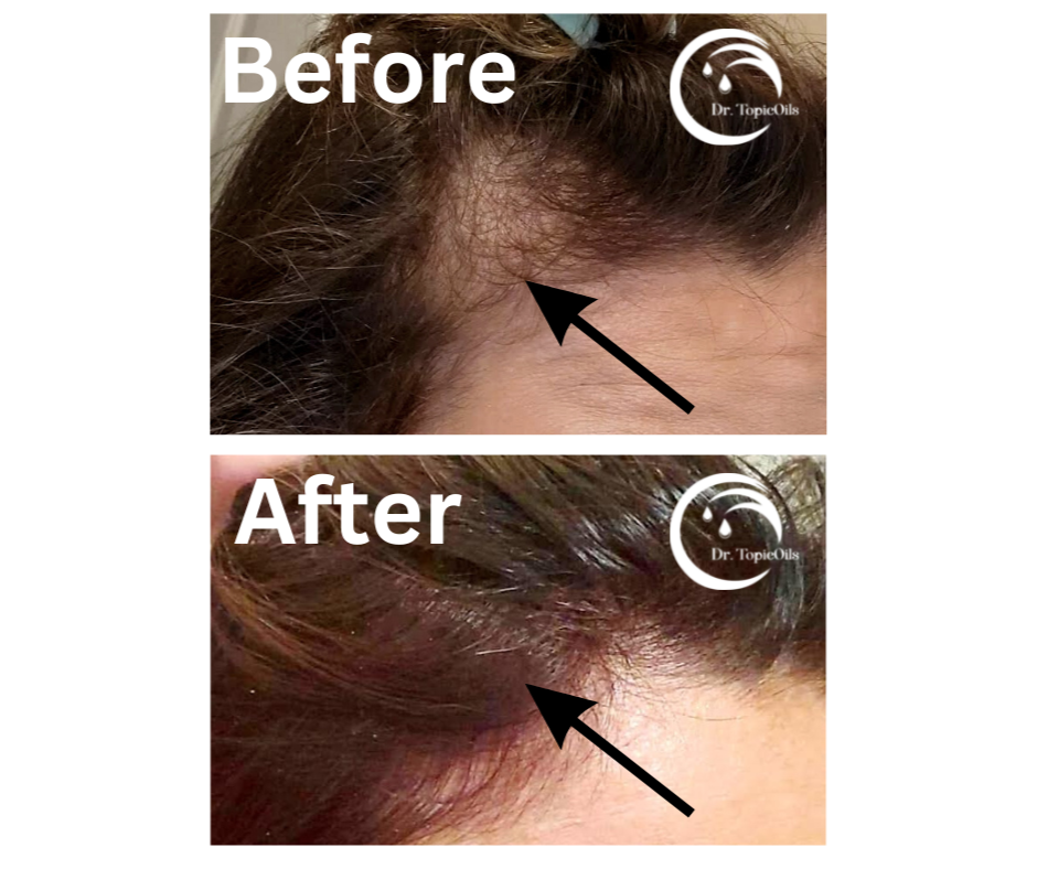 Dr. TopicOils Fountain Of Youth (Skin Care & Hair Growth Bundle)